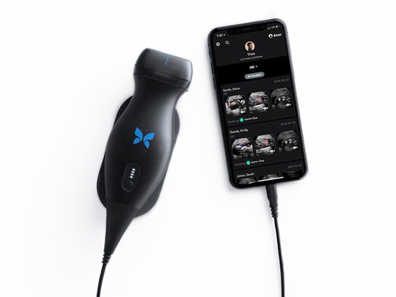 Универсальный портативный датчик Butterfly iQ