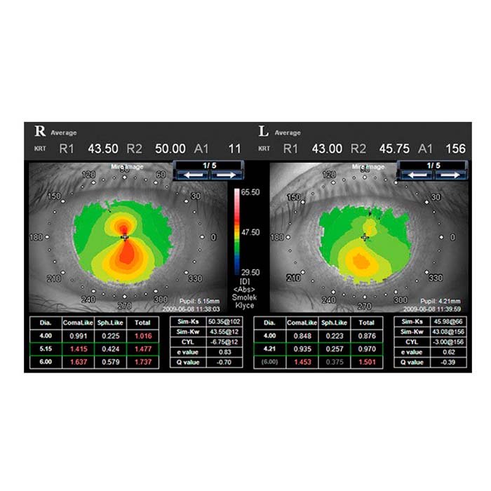 Анализатор волнового фронта KR-1W, Topcon