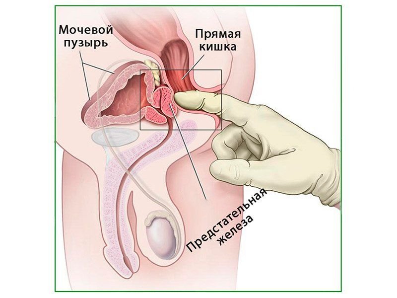 OLD Пальпация предстательной железы, плакат глянцевый А1/А2 (глянцевый A2)