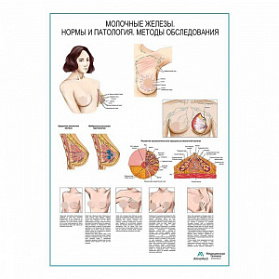 Молочные железы, мастопатия, самообследование, плакат глянцевый А1+/А2+ (матовый холст от 200 г/кв.м, размер A1+)