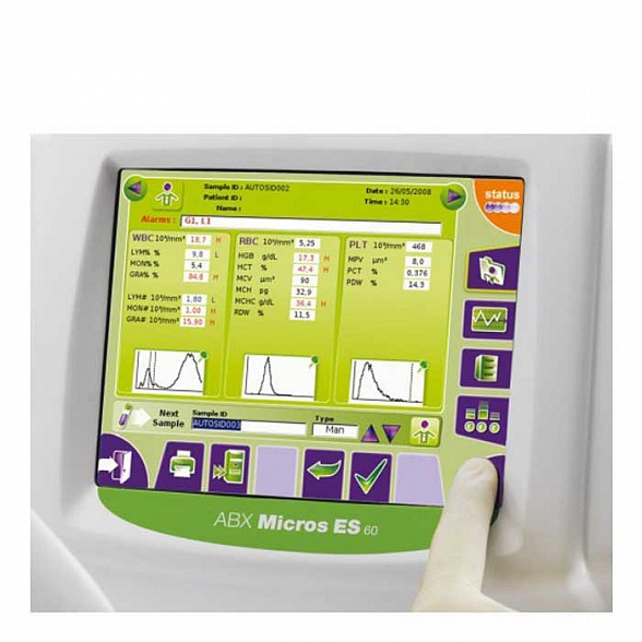 Гематологический анализатор MICROS ES 60