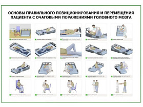 OLD Основы правильного позиционирования и перемещения пациента с очаговыми поражениями головного мозга плакат глянцевый А1/А2 (глянцевый A2)