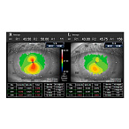 Анализатор волнового фронта KR-1W, Topcon