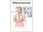 OLD Фиброгастроскопия, плакат глянцевый А1/А2 (глянцевый A2)