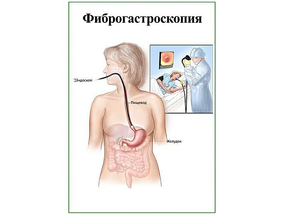 OLD Фиброгастроскопия, плакат глянцевый А1/А2 (глянцевый A1)