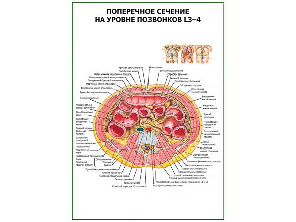 OLD Поперечное сечение на уровне L 3-4 плакат глянцевый  А1/А2 (глянцевый A2)