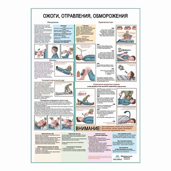 Ожоги, отравления, обморожения, плакат глянцевый А1+/А2+ (глянцевая фотобумага от 200 г/кв.м, размер A2+)