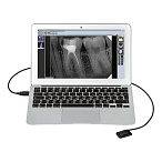 Комплект рентген Evolution X3000 и визиограф Mercury DIGISENS
