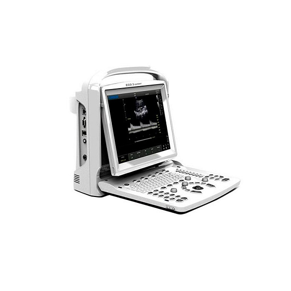 УЗИ сканер SonoTouch 20 Chison