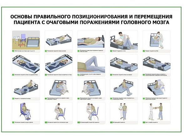 OLD Основы правильного позиционирования и перемещения пациента с очаговыми поражениями головного мозга плакат глянцевый А1/А2 (глянцевый A1)