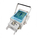 Портативный рентген DS.Xray 8010tb