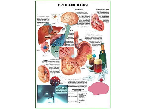OLD Вред алкоголя плакат глянцевый А1/А2 (глянцевый A1)