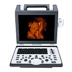 Портативный УЗИ аппарат SIUI CTS-8800