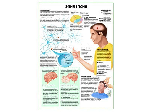 OLD Эпилепсия плакат глянцевый А1/А2 (глянцевый A2)