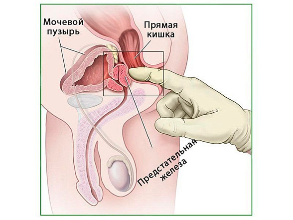 OLD Пальпация предстательной железы, плакат глянцевый А1/А2 (глянцевый A1)