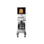 УЗИ аппарат SonoAce R7 Samsung Medison