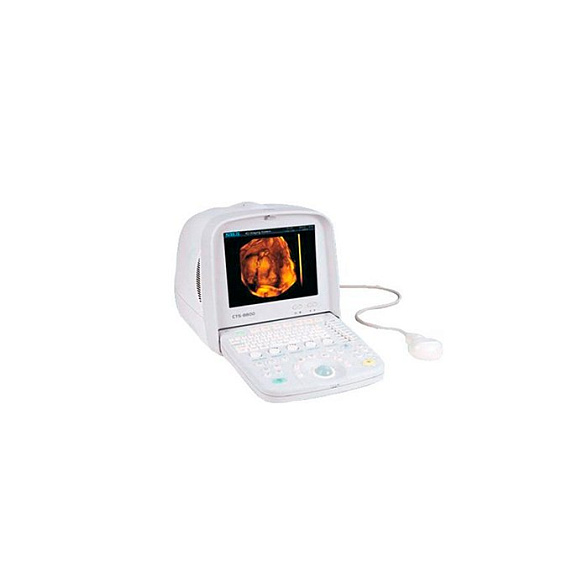 Портативный ультразвуковой сканер CTS 7700 Plus (COLOR) SIUI